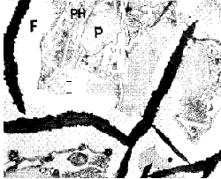 Common grey iron showing ferrite,pearlite,and phosphide eutectic 